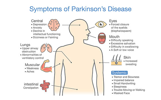 Symptoms of Parkinson's disease 