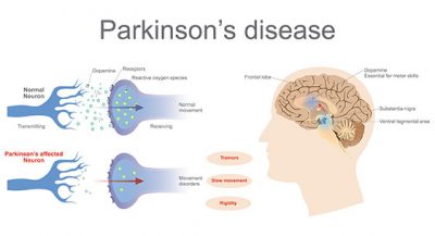 Parkinson’s Disease - Parkinson’s Care and Support UK